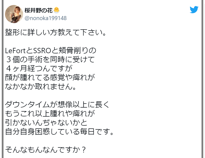 桜井野の花の本名は渚りえ 整形のビフォー画像が衝撃 顔面麻痺してた Rzm Headline